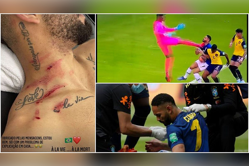 Matheus Cunha bị rách vai và cổ sau cú đạp thô bạo từ thủ môn Ecuador