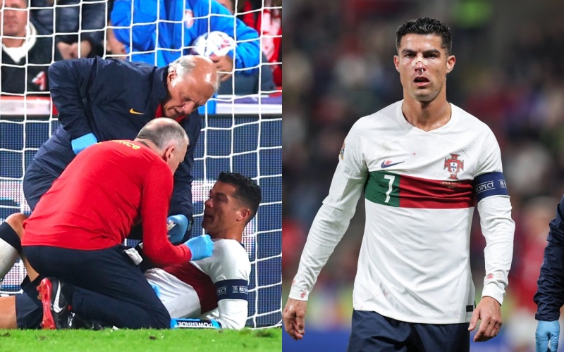 Cristiano Ronaldo được điều trị và tiếp tục thi đấu