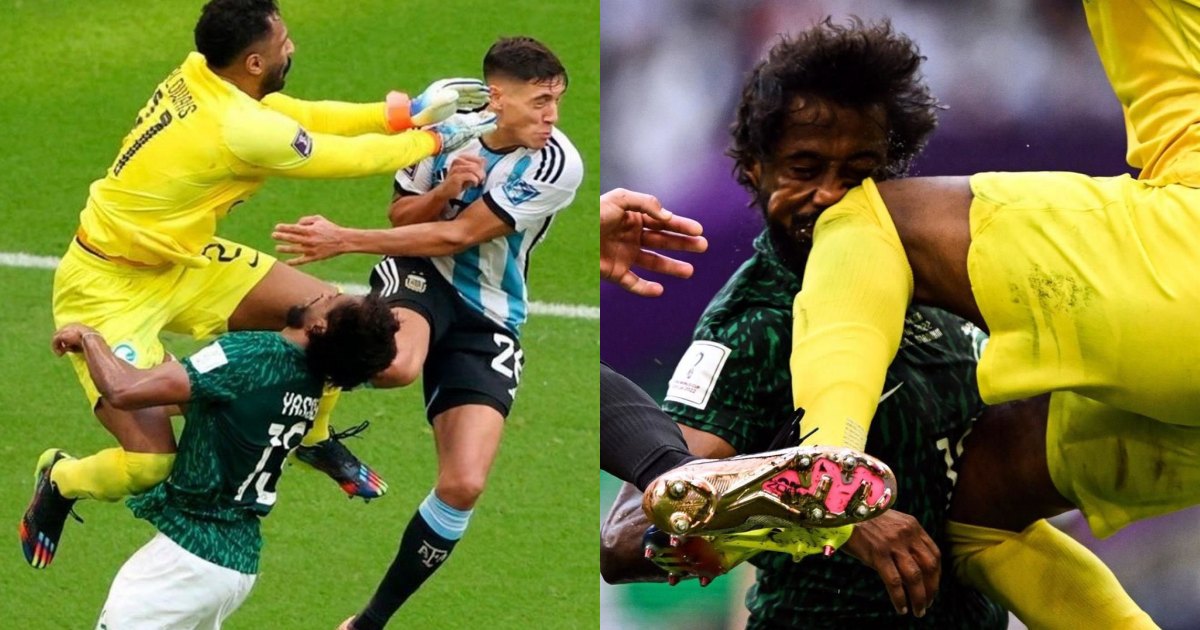 VIDEO: Hậu vệ Saudi Arabia dính chấn thương kinh hoàng trong trận thắng Argentina