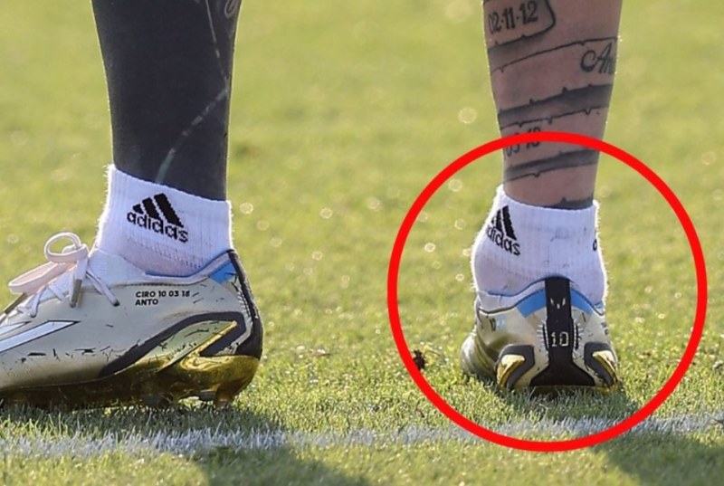 Mắt cá chân của Messi to bất thường