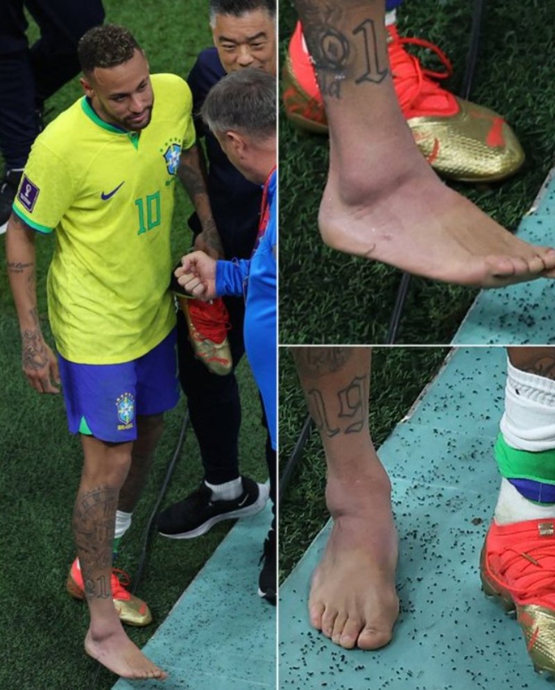 Neymar Jr đối diện nguy cơ chia tay World Cup 2022 vì chấn thương mắt cá